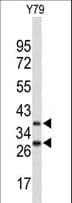 FBXO4 / FBX4 Antibody (aa225-251)