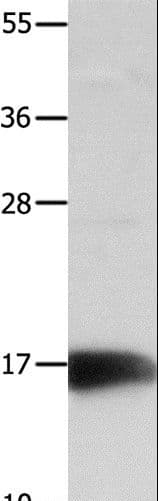 Polyclonal Rabbit anti-Human NME3 Antibody (WB)