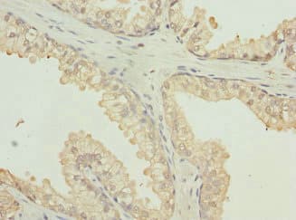 HPTPB / PTPRB Antibody