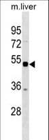 STK38 Antibody (aa429-458)