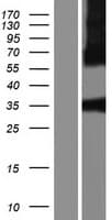 Human SIRT5 / Sirtuin 5 Protein (Over-Expression Lysate Myc-DDK (Flag))