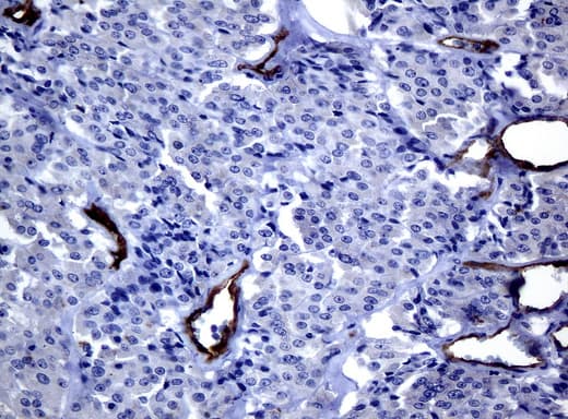 FOLH1 / PSMA Antibody (clone UMAB25, Carrier-free)
