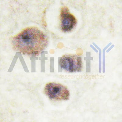 FAK / Focal Adhesion Kinase Antibody