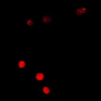 SSX5 Antibody