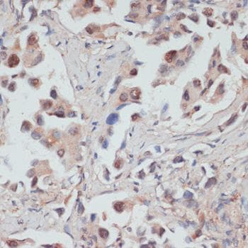 Polyclonal Rabbit anti-Human TES / Testin Antibody (IHC)