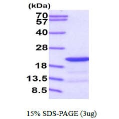 Human PIN4 Protein (Recombinant His)