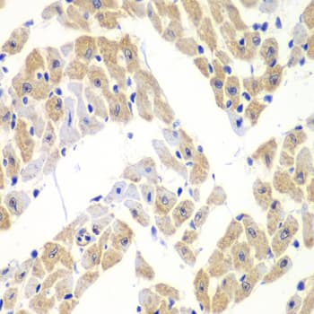 ELF3 / ESE1 Antibody