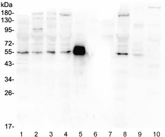 Polyclonal Rabbit anti-Human MMP13 Antibody (WB)
