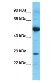Polyclonal Rabbit anti-Human NPM2 Antibody (aa1-50, WB)
