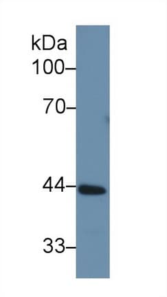SERPINA6 / CBG Antibody (aa173-344)