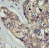 DOK5 Antibody (aa276-306)
