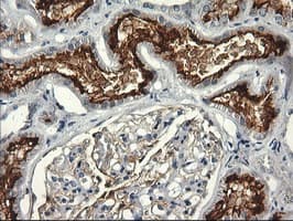 Monoclonal Mouse anti-Human RGS16 Antibody (clone OTI4F9, IHC, WB)