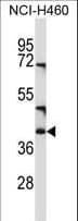 CD1C Antibody (aa226-253)