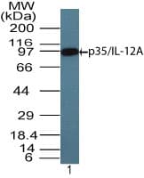 Polyclonal Rabbit anti-Human IL12A / p35 Antibody (aa200-250, WB)
