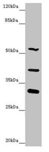 Polyclonal Rabbit anti-Human NYX Antibody (IHC, WB)