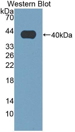 CD144 / CDH5 / VE Cadherin Antibody (aa69-391, PE)