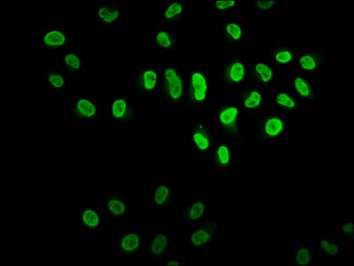 HIST1H2BN Antibody