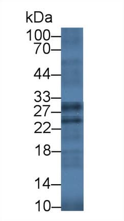 GZMK / Granzyme K Antibody (aa44-227)
