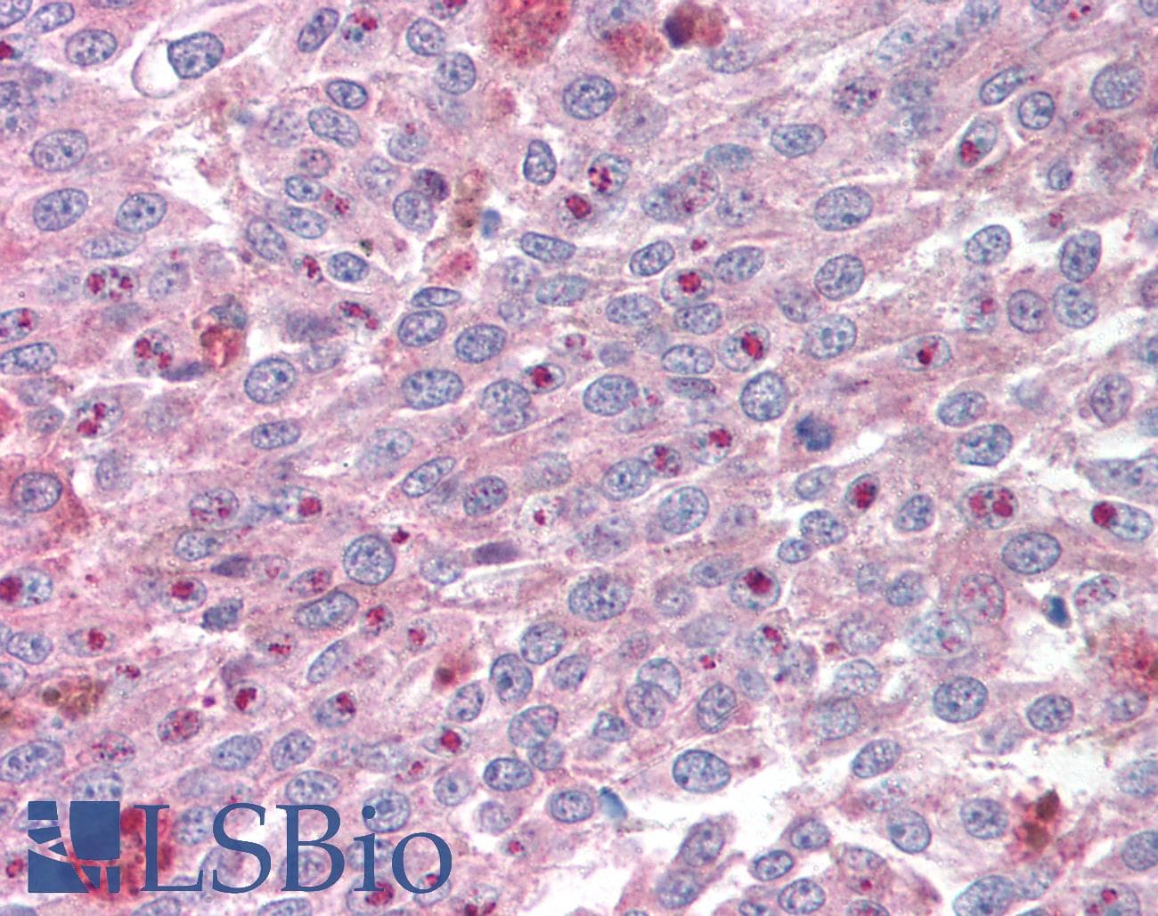 KLF4 Antibody (aa80-129)