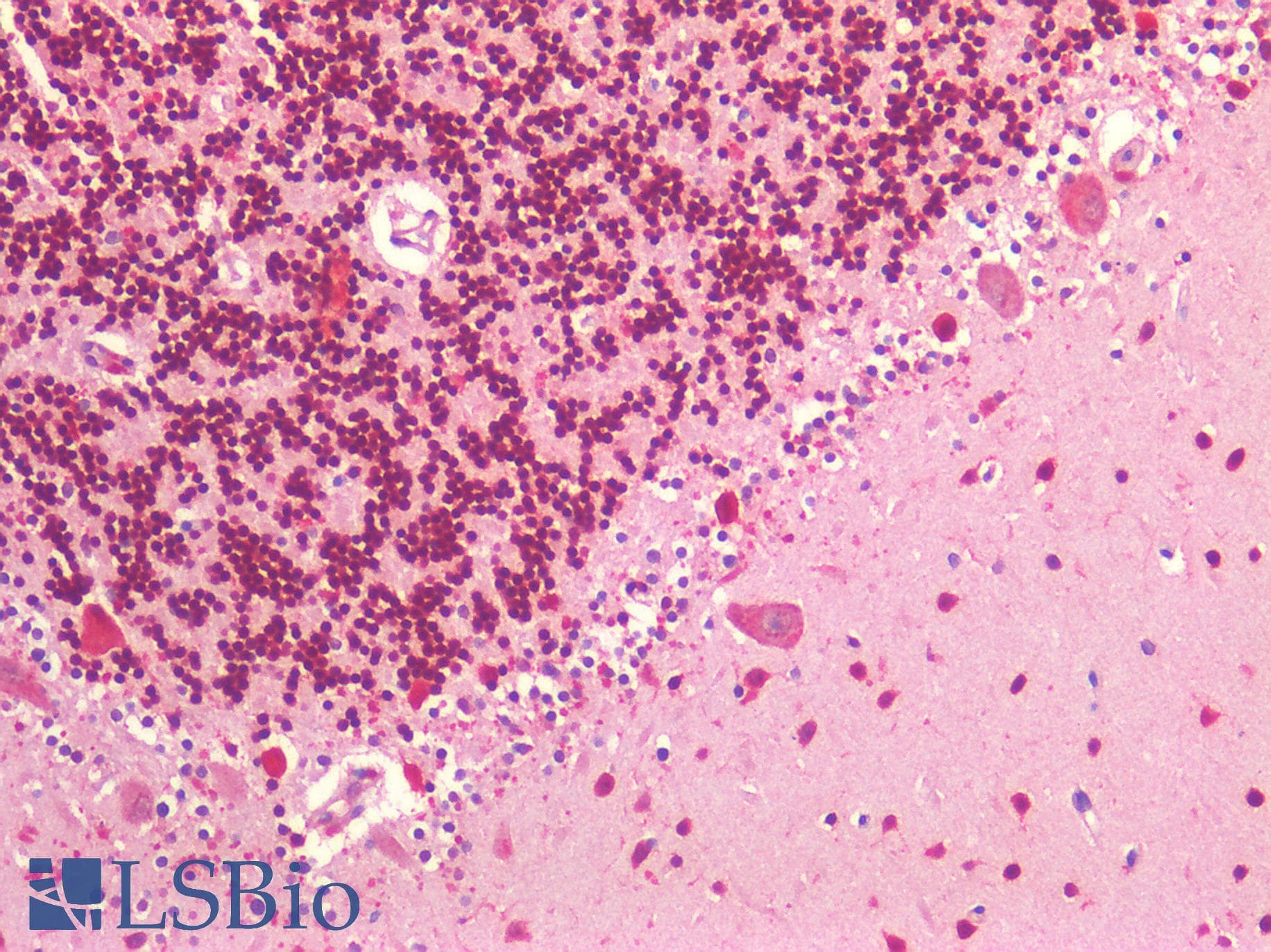 IHC-plus™ IGF1R / IGF1 Receptor Antibody