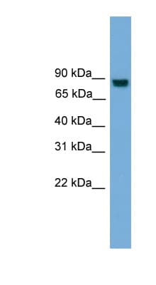 EXOC8 / EXO84 Antibody (N-Terminus)