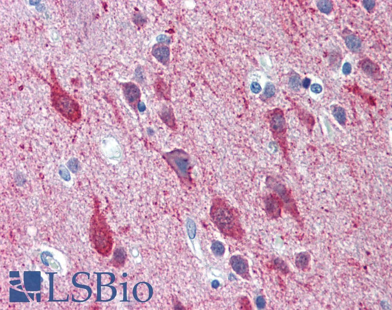 PathPlus™ Polyclonal Rabbit anti-Human KCNC2 / Kv3.2 Antibody (aa589-638, IHC, WB)