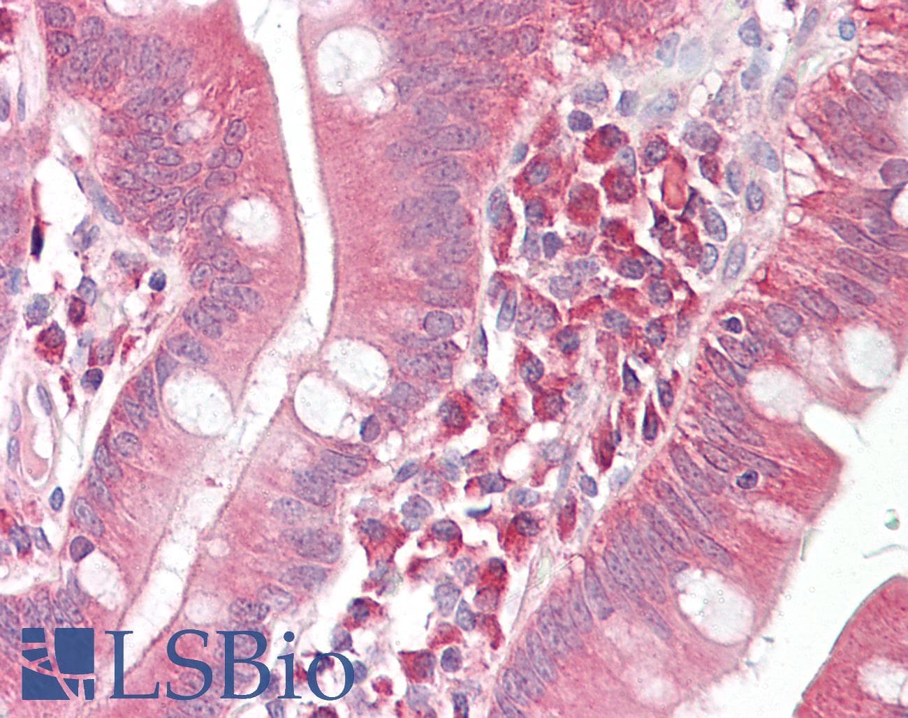 PathPlus™ GAD1 / GAD67 Antibody (aa471-520)