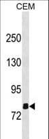 Polyclonal Rabbit anti-Human OLFML2B Antibody (aa171-198, WB)