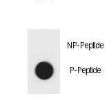 Polyclonal Rabbit anti-Mouse IKBKB / IKK2 / IKK Beta Antibody (phospho-Ser701)
