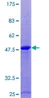 Human RAB18 Protein (Recombinant GST)