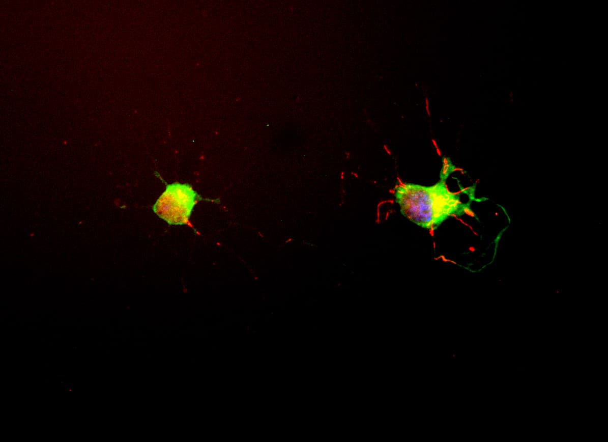 PathPlus™ MAPT / Tau Antibody (clone MCA-2E9)