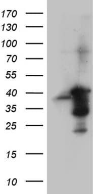 Polyclonal Rabbit anti-Human PRKAB1 / AMPK Beta 1 Antibody (WB)
