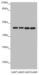 PDHA2 / PDH E1 Beta Antibody