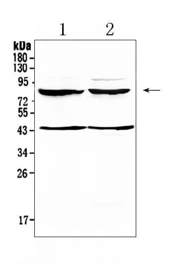 TSH Receptor / TSHR Antibody