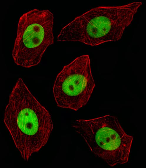 IHC-plus™ Polyclonal Rabbit anti-Human GTF2I / TFII I Antibody (aa956-985, IHC, IF, WB)