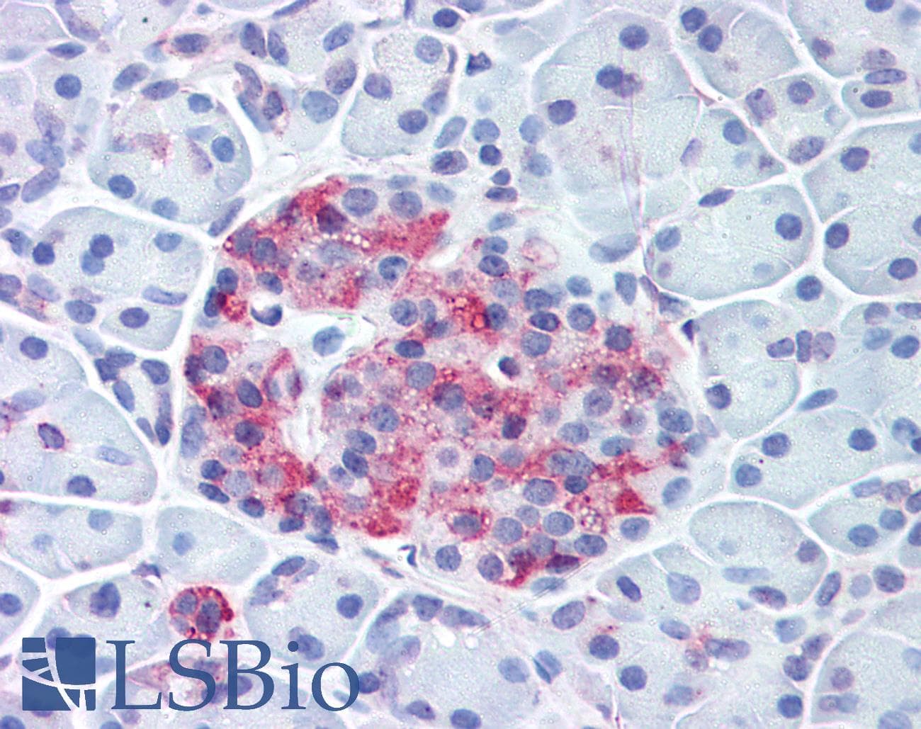PathPlus™ Polyclonal Rabbit anti-Human WNT10A Antibody (Internal, IHC)