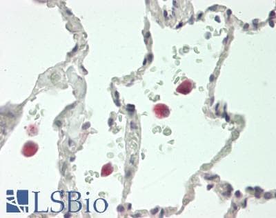 IHC-plus™ Polyclonal Rabbit anti-Human DEFB4A / BD-2 Antibody (Internal, IHC, WB)