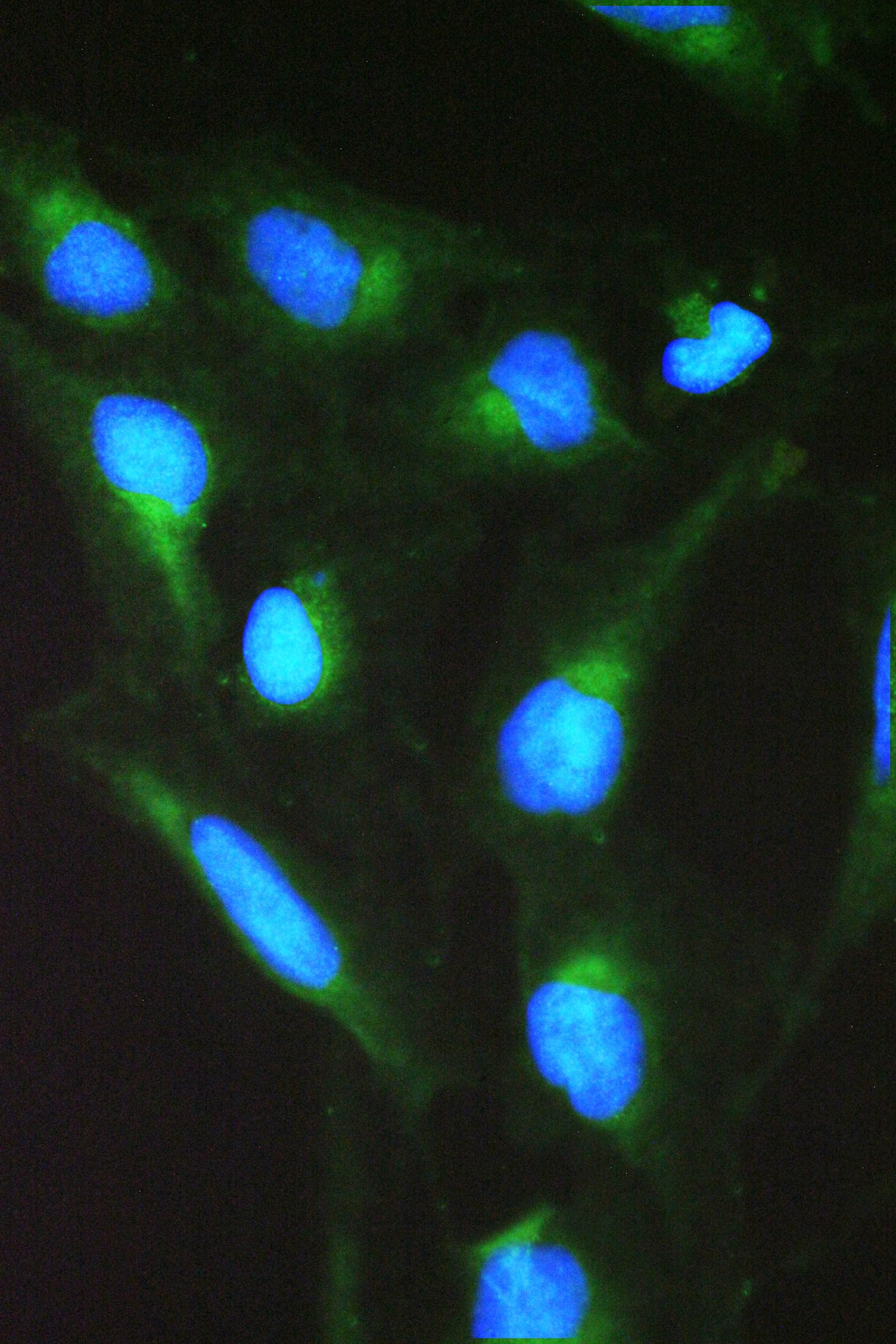 SPTLC1 / HSN1 Antibody (aa444-473)
