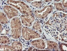 AGPAT5 Antibody (clone OTI2C4)