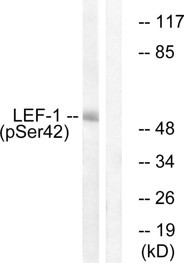 Polyclonal Rabbit anti-Human LEF1 Antibody (phospho-Ser42, WB)
