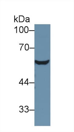 Antithrombin Antibody (aa33-465)