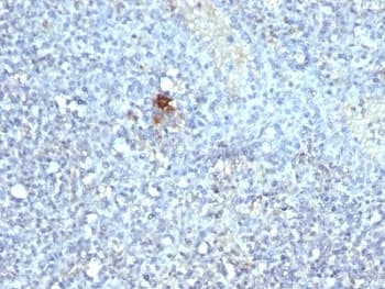 ACP5 / TRAP Antibody (clone ACP5/1070)