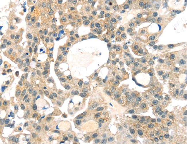 RRAGA Antibody
