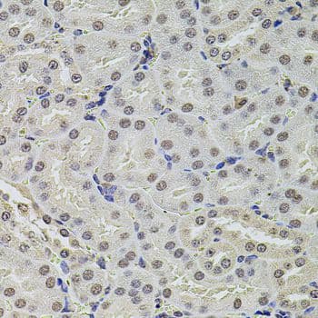 SET / TAF-I Antibody