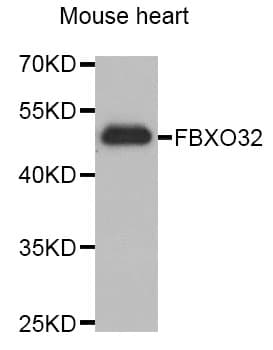 Polyclonal Rabbit anti-Human FBXO32 / Fbx32 Antibody (WB)