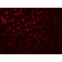 IHC-plus™ Polyclonal Rabbit anti-Human SAMHD1 Antibody (IHC, IF, WB)