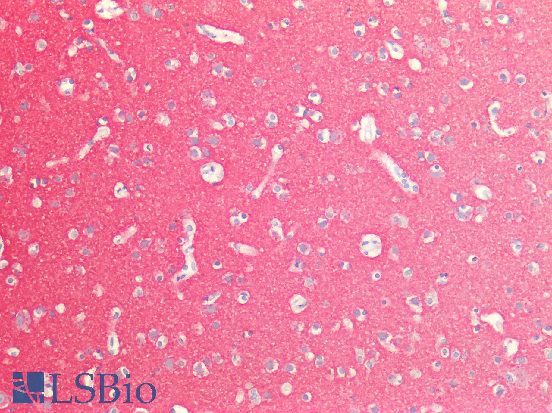 PathPlus™ Polyclonal Rabbit anti-Human SNAP25 Antibody (IHC, WB)