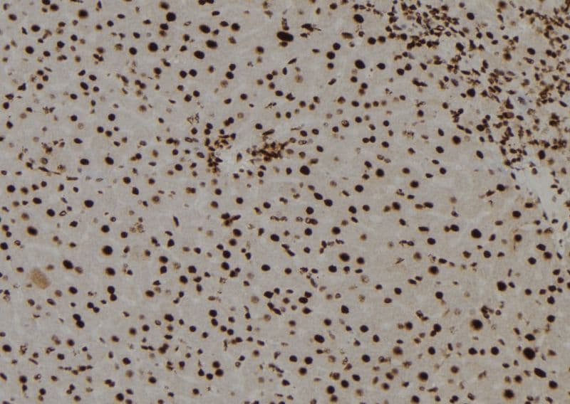 Polyclonal Rabbit anti-Human TGIF2LY Antibody (IHC, WB)