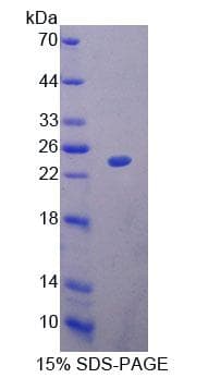 Rat BM022 / MRPL1 Protein (Recombinant His-T7)