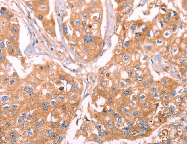 GC / Vitamin D-Binding Protein Antibody